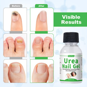 ZERBI applying gel to toenail demonstrating targeted softening and easier trimming