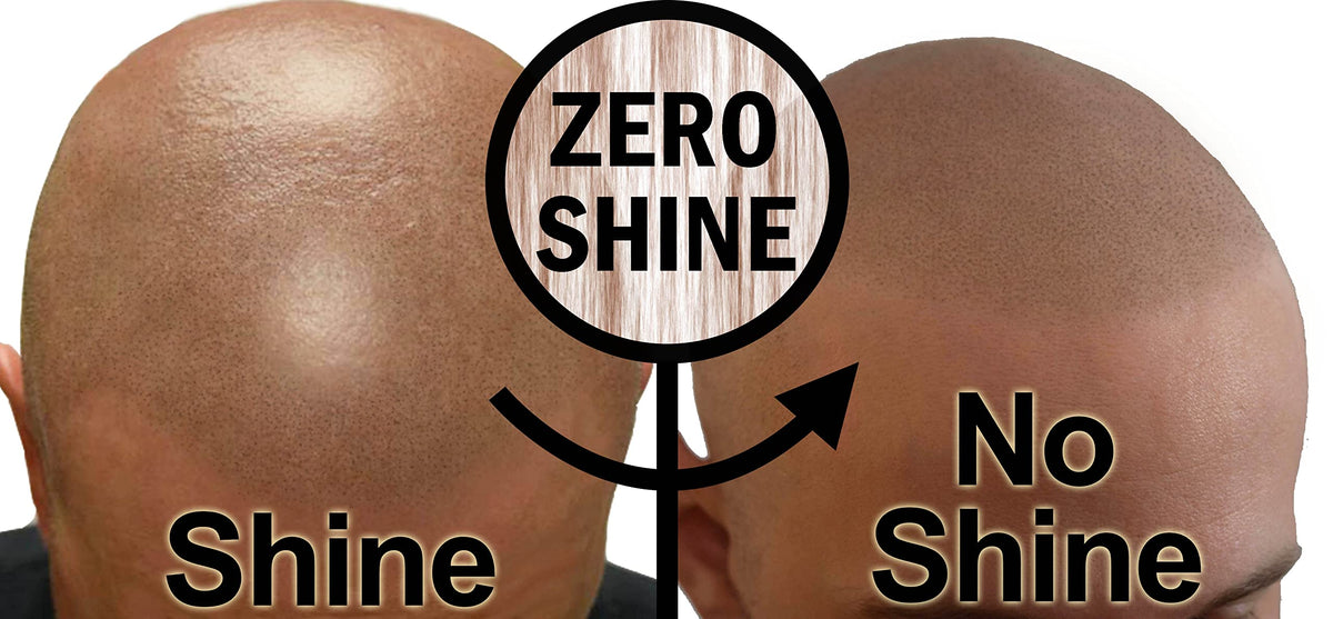 Zero Shine applied on SMP-treated scalp showing reduced shine and crisp pigment