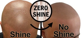 Zero Shine applied on SMP-treated scalp showing reduced shine and crisp pigment