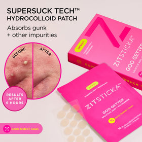 ZitSticka patch applied to cheek demonstrating discreet coverage and protection