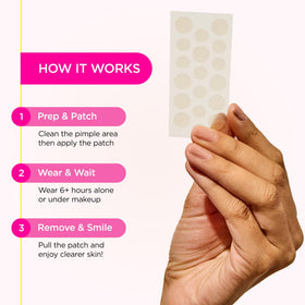ZitSticka patches in hand illustrating multiple sizes for targeted spot coverage