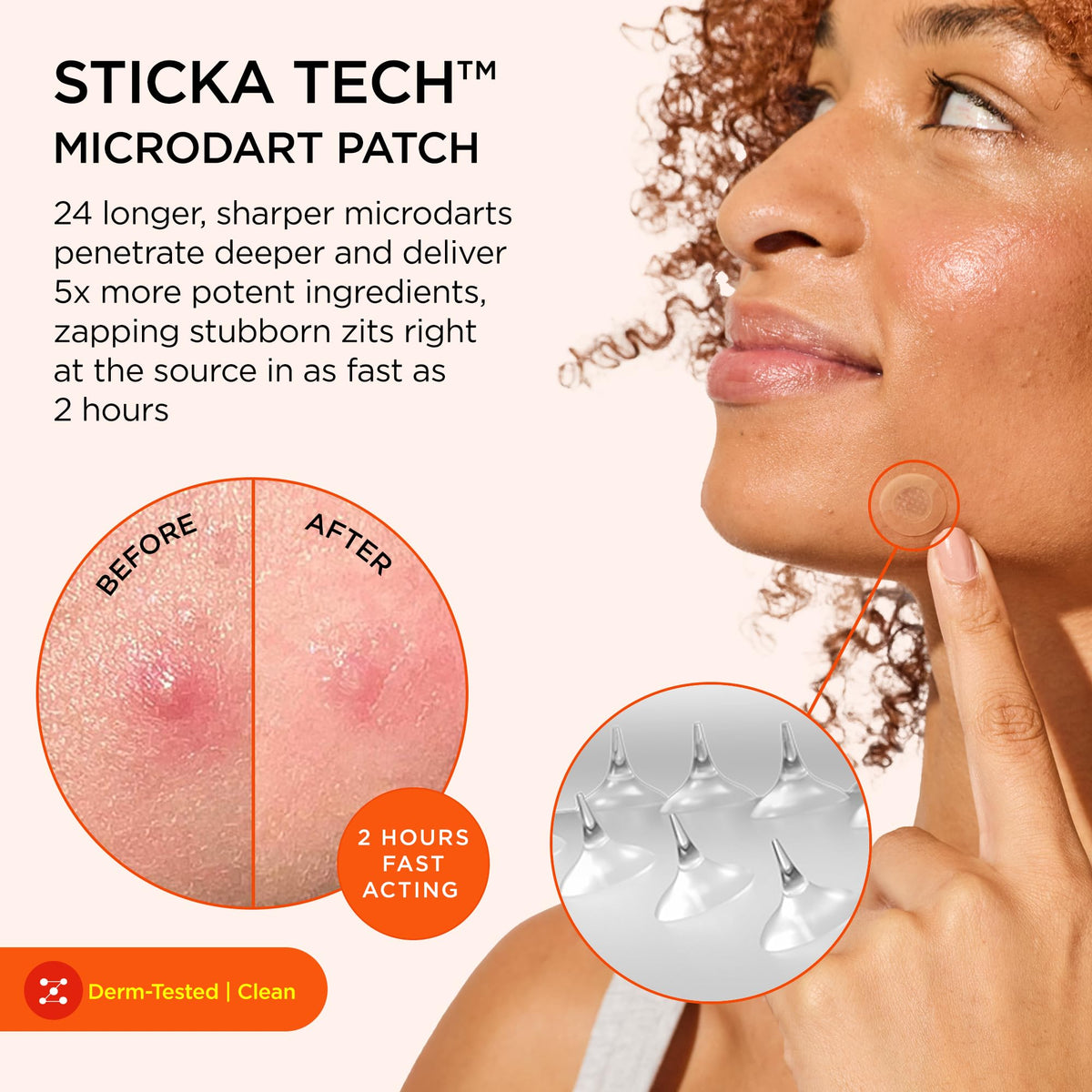 ZitSticka microdart patch close-up highlighting precise delivery