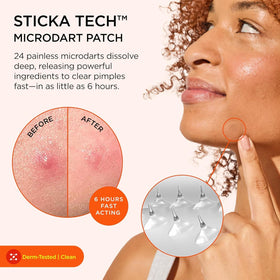 ZitSticka patch close-up revealing thin patch texture and strong adhesion benefit
