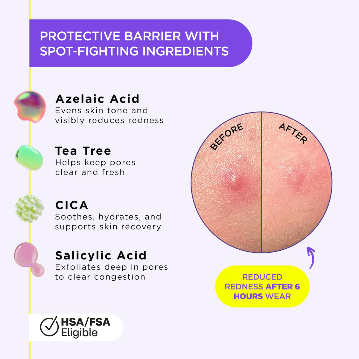 ZitSticka clear film on skin demonstrating invisible protection and confident wear