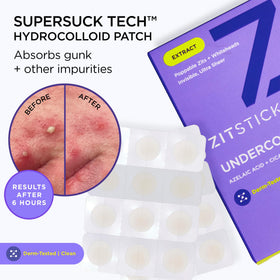 ZitSticka patches next to coin showing size and count convenience benefit