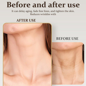 ziyue patch applied to décolletage illustrating crease protection while resting