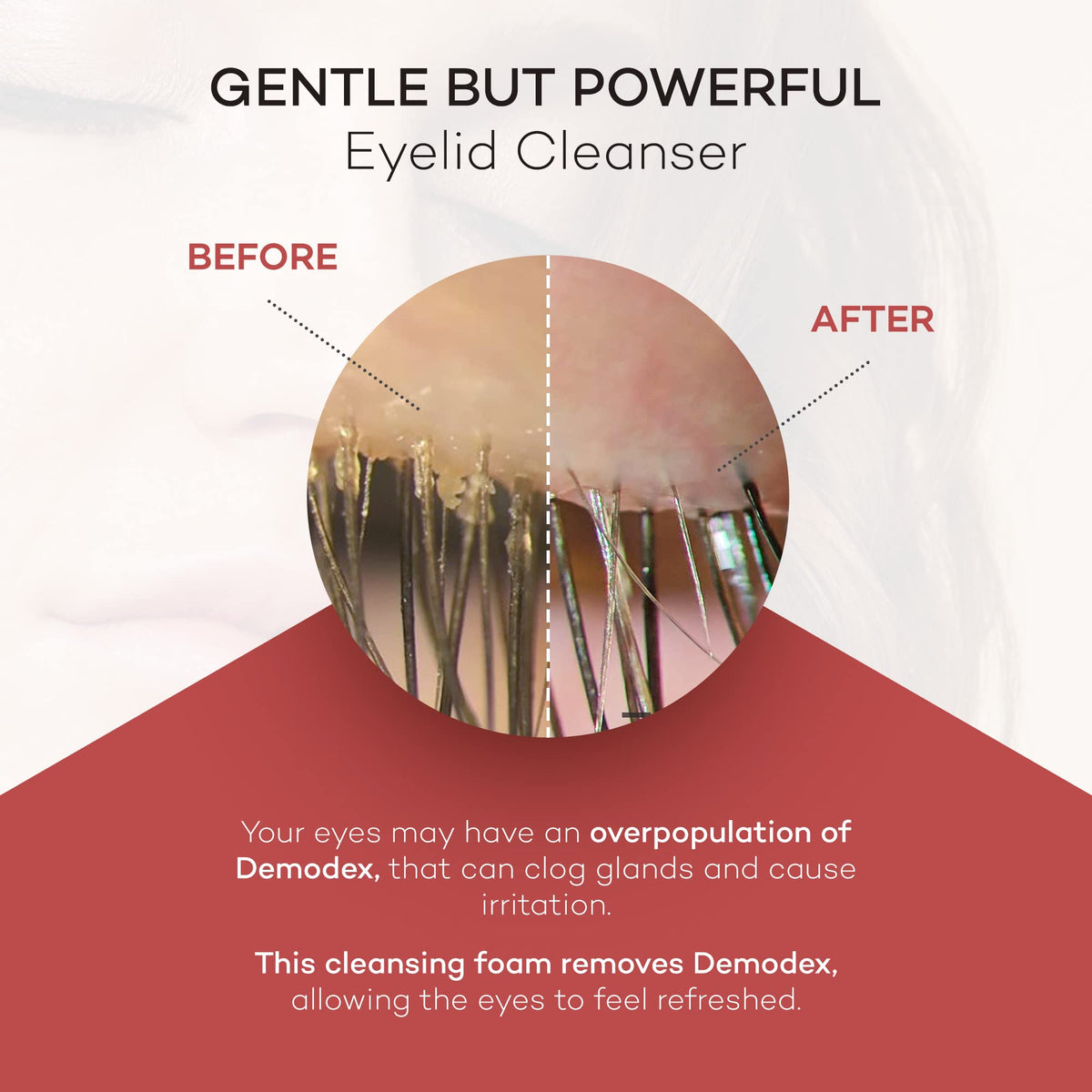 Zocular ZocuFoam being massaged on closed eyelid, helps remove makeup and debris