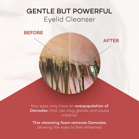 Zocular ZocuFoam being massaged on closed eyelid, helps remove makeup and debris