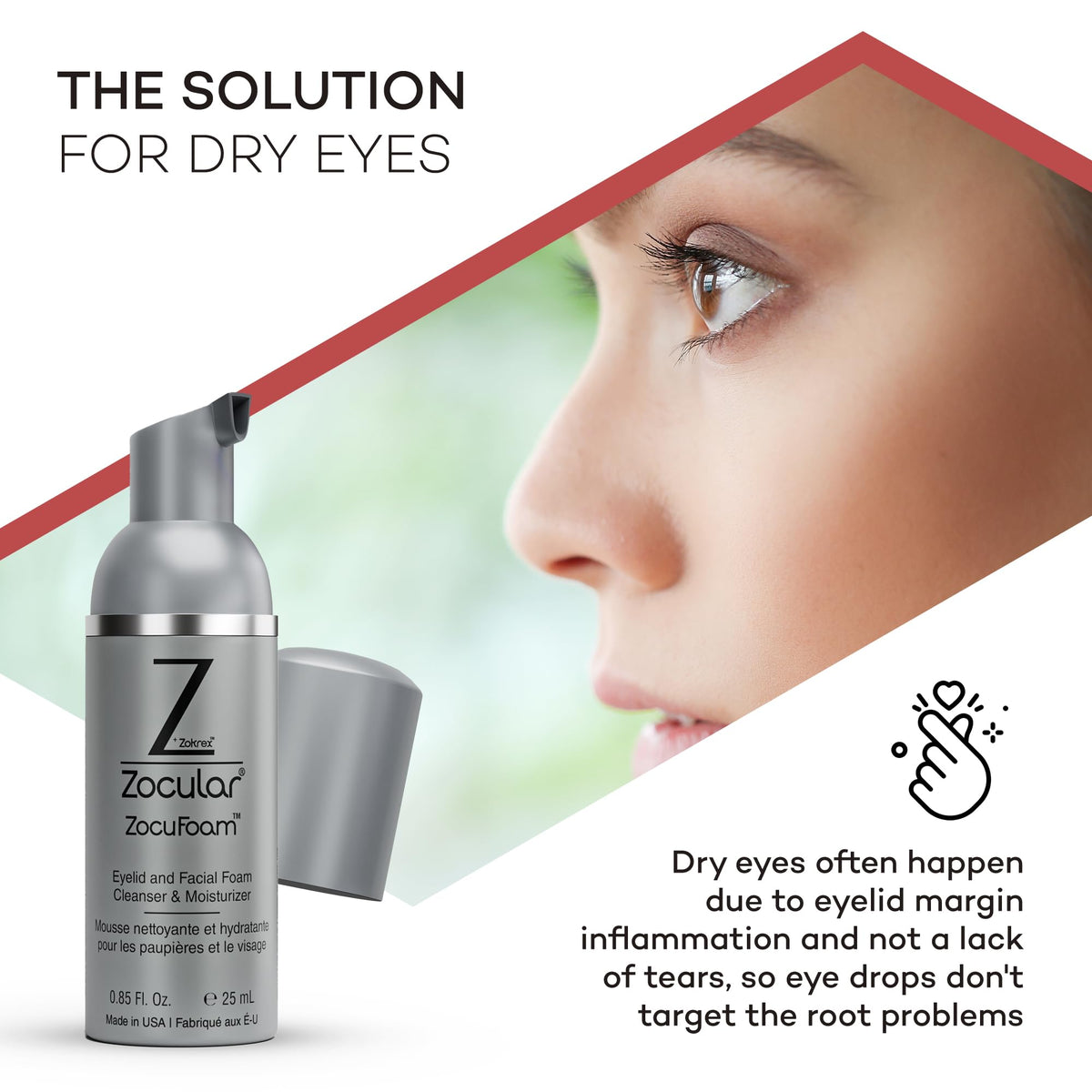 Zocular foam applied to cotton pad demonstrating easy eyelid cleansing benefit