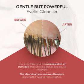 Zocular label close-up highlighting ingredients and gentle formulation benefit