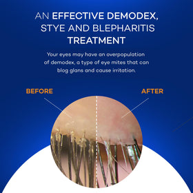 Ingredients label on Zocular Zocuwipe jar, highlights Zokrex okra complex transparency benefit