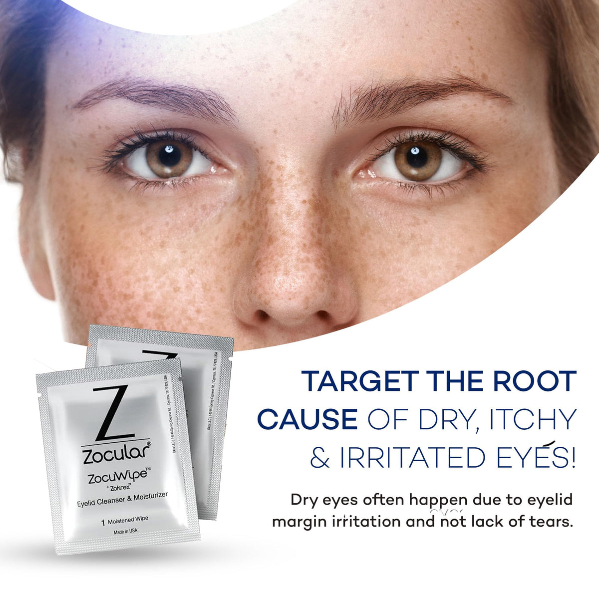Zocular ZocuWipe single pre-moistened wipe unfolded for gentle eyelid cleansing