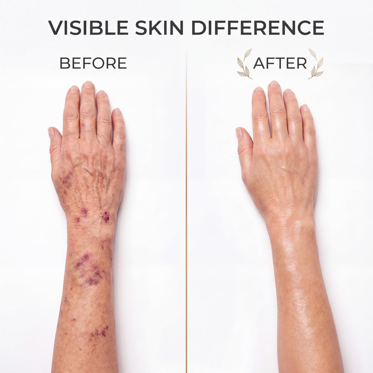 ZRRTXV arnica and vitamin K visuals showing key-ingredient support