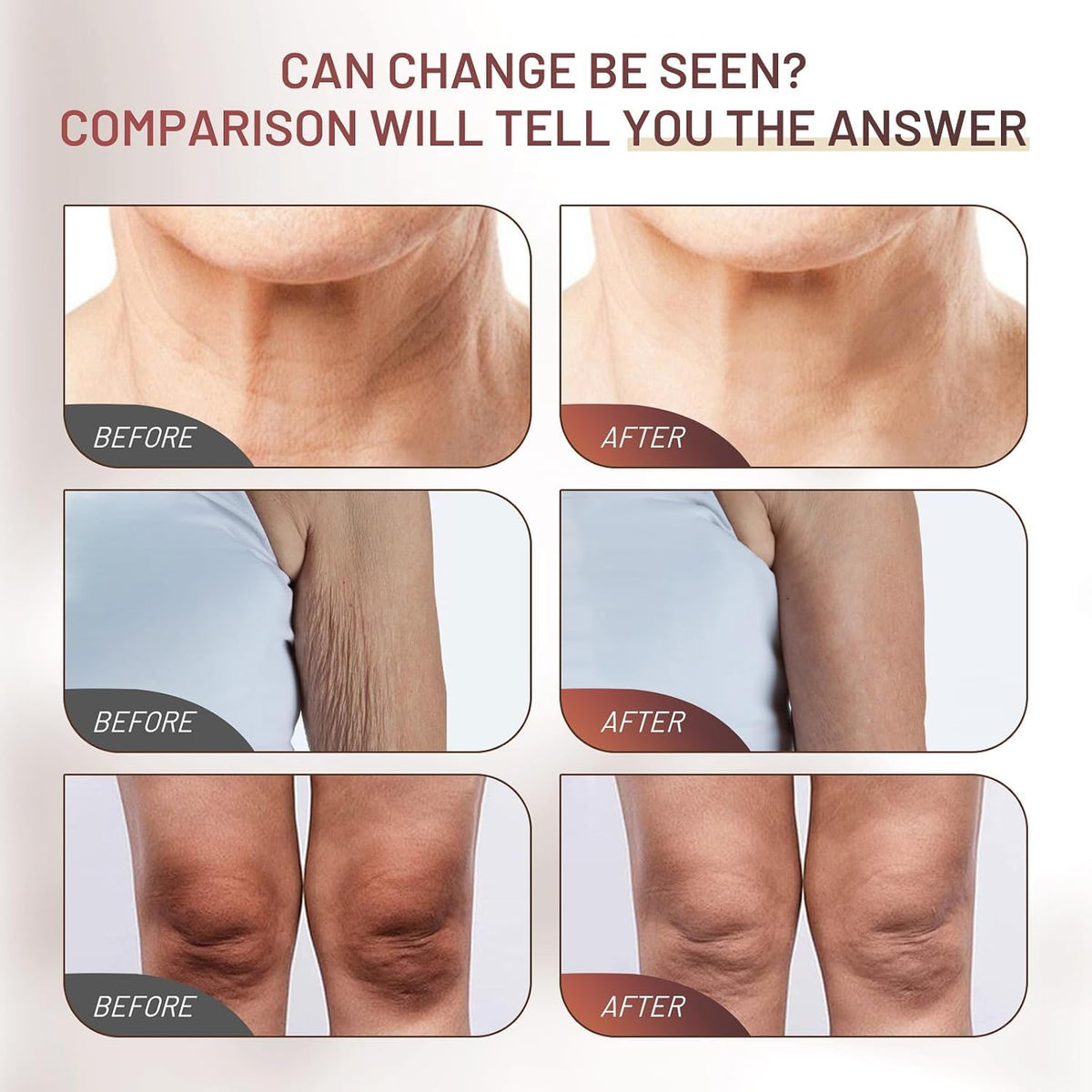 ZZILME cream on hand application showing instant softening
