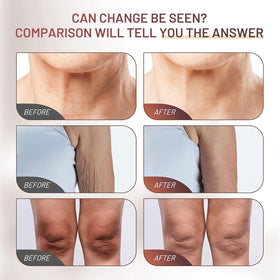 ZZILME cream on hand application showing instant softening
