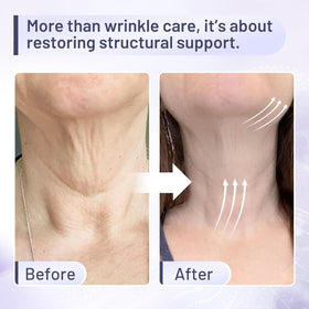 ZZILME cream texture close-up highlighting smooth hydration